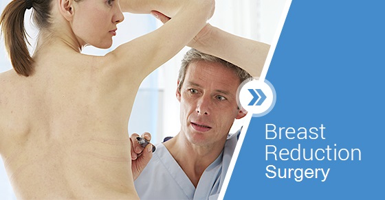 breast reduction surgeries